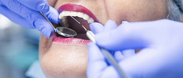 Best Emergency Wisdom Teeth Removal in Goldenrod, FL